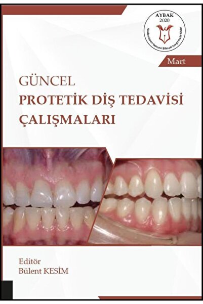 Akademisyen Yayınevi Güncel Protetik Diş Tedavisi Çalışmaları ( Aybak 2020 Ma...