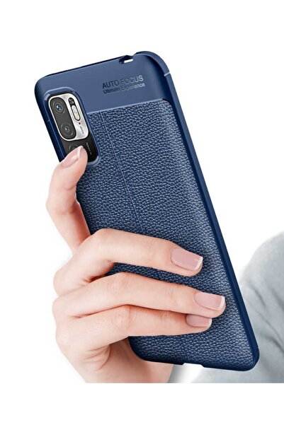 HopyKent Redmi Note 10 5g Kılıf Deri Görünümlü Koruyucu Silikon