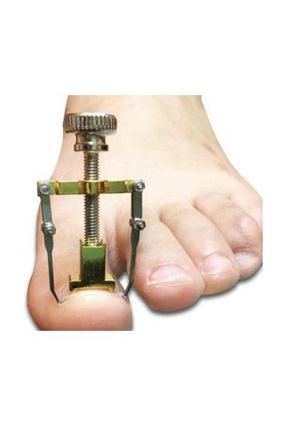 MUJGAN Ingrown Nail Remover Apparatus