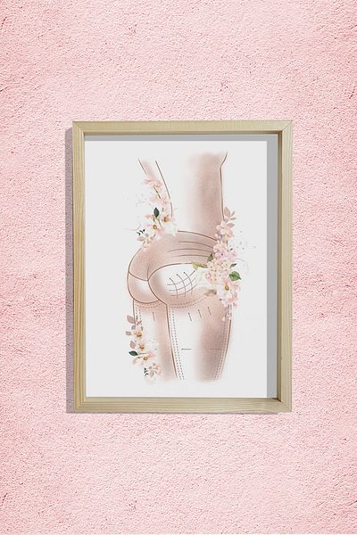 Dekor Loft Buttocks Brazilian, Artă de ridicare a feselor, Chirurgie plastica și estetică, Pictură murală pentru camera medicului