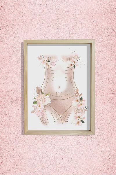 Dekor Loft Mother Aesthetic Abdominal Toning Art Liposucție Chirurgie Plastică și Estetică Doctor Room Pictură murală