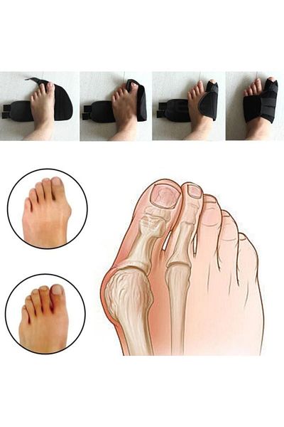 Ankaflex Hallux Valgus Night Splint Corrector Treatment Foot Thumb Bone Protrusion Bunion Bone Protector