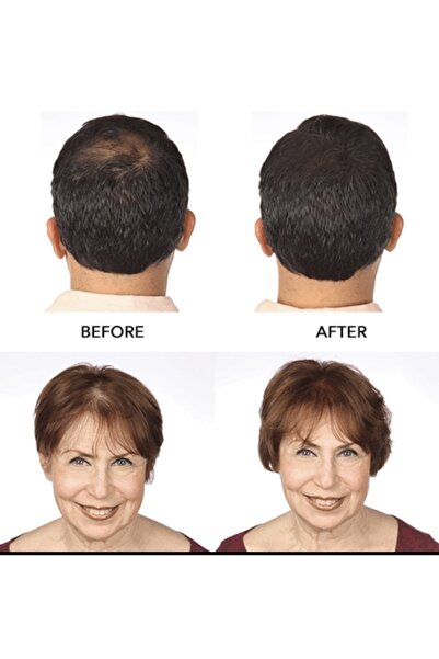 HairMax For Density Hairmax Hair Fibers Topik