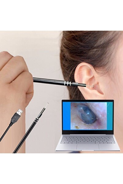 pengheng Kulak Temizleme Aracı Kaşık Hd Kamera Aracı Usb Tipi C Soket Win & A...