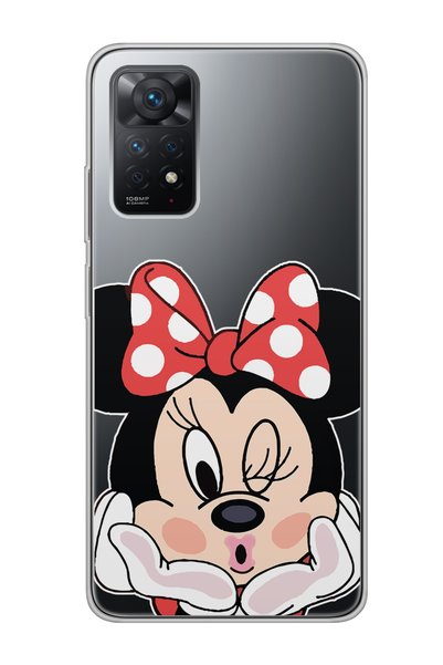 Spoyi حافظة هاتف شفافة بتصميم ميني لهاتف Xiaomi Redmi Note 11