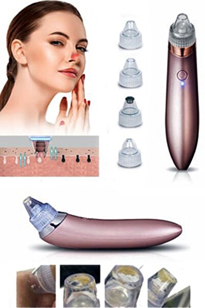 MOBEE Vakumlu Akne Siyah Nokta Leke Çıkarıcı Cilt Temizleme Aleti 4 Başlıklı