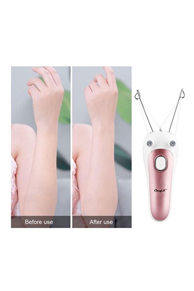 Egonex -profesyonel Epilatör Ipli Tüy Alma Makinesi Epilasyon Aleti