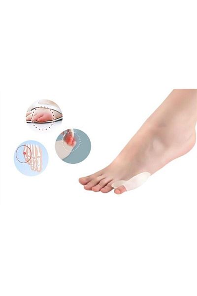 Bunyon Foot Little Finger Roller Bone Protector Bunion Little Finger Bone Protrusion Prevention Corrector