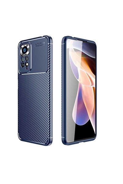Nezih Case Xiaomi Redmi Note 11 Uyumlu Global Uyumlu Kamera Korumalı (carbon ...