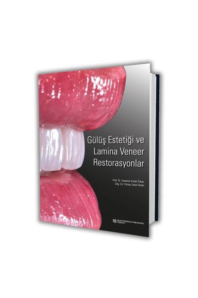 Genel Markalar Gülüş Estetiği Ve Lamina Veneer Restorasyonlar