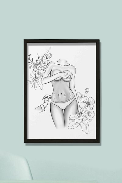 Dekor Loft Semne chirurgicale estetice, lifting abdominal, chirurgie plastica si estetica, tablou de perete pentru camera medicului