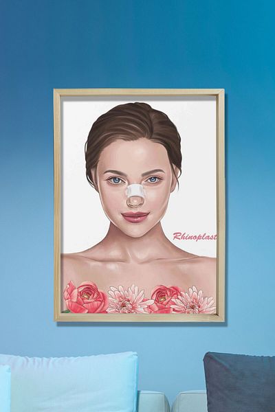 Dekor Loft Rinoplastie, Chirurgie Reconstrucțională, Chirurgie Plastică și Estetică, Diagramă de perete pentru camera medicului