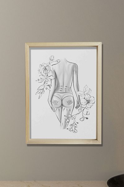Dekor Loft Modelarea corpului, slăbire, chirurg plasture și estetică, pictură murală pentru camera medicului