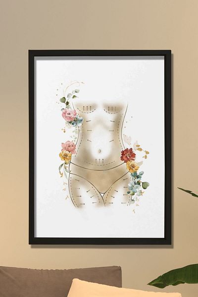 Dekor Loft Estetică Maternă, Lifting Abdominal, Liposucție, Chirurgie Plastică și Estetică, Tablou de perete pentru camera medicului