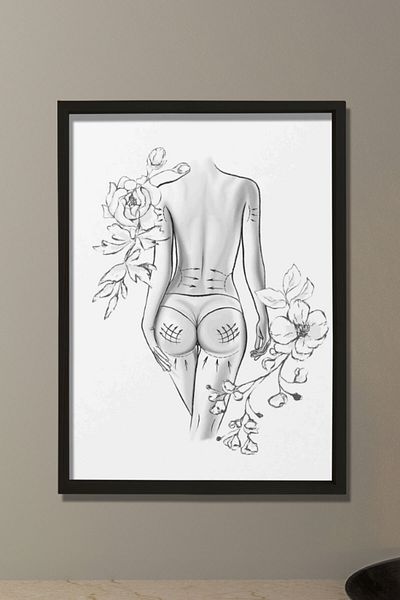 Dekor Loft Modelarea corpului, slăbire, chirurg plasture și estetică, pictură murală pentru camera medicului