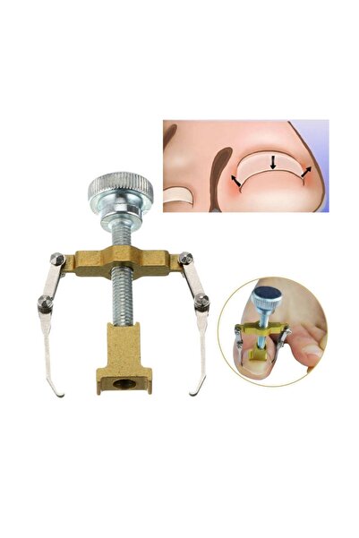 MUJGAN Adipa Ea Profesyonel Batık Tırnağı Düzeltme Aparatı