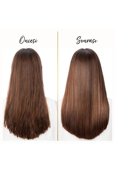 Pantene 400 Ml X4 Shampoo Effective Against Dandruff