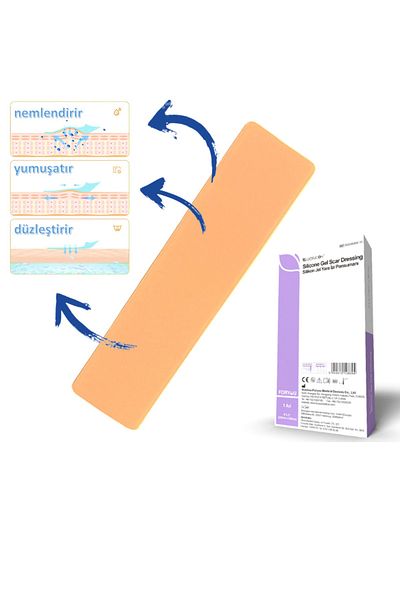 luofucon 5X20CM Silicone Gel Scar Remover Tape - Acne, Scar Keloid and Stretch Marks Surgery Scar Remover