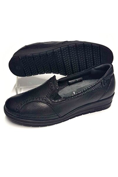 Forelli Anatomik Deri Kemik Çıkıntısına Uygun Siyah Ayakkabı 25109