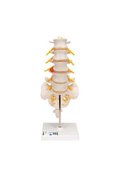 Medikal Market TR 3b Scientific Dorsolateral Bel Fıtığına Sahip Bel Omurga Maketi