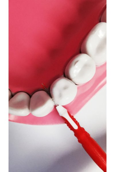Pearldent Iso 2 Super - فرشاة واجهة مغطاة 0.45 مم، مجموعة من 6 قطع