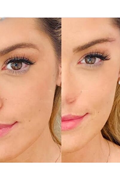 AKOLİFE Krem-bej Renk Facelift Kaş Göz Ve Yüz Germe Botoks Etkili Sihirli Toka