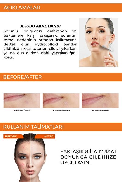 JEJUDO Original Pimple Patch, 2X36 adet şeffaf bant, Hidrokolloid bant, Akne Bandı, Akne yaması