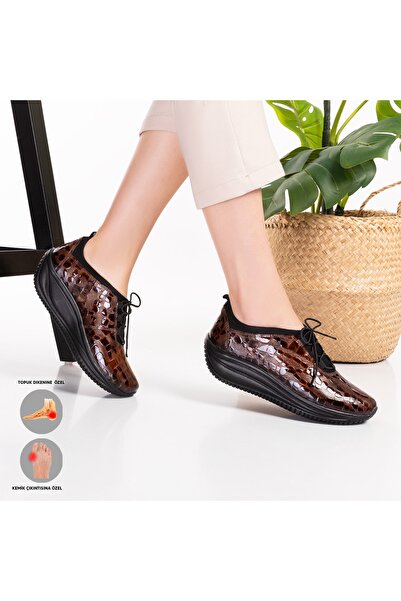 Mira Terlik Τα γυναικεία δερμάτινα παπούτσια Mira Orthopedic είναι κατάλληλα ...