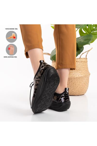 Mira Terlik Mira Ortopedik Kadın Deri Ayakkabı Topuk Dikeni Kemik Çıkıntısı Için Uygundur