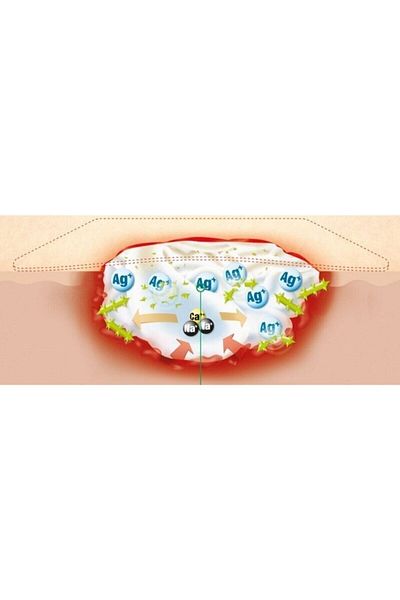 LOHMAN&RAUSHER Suprasorb a Ag 10x20 Cm Silver-calcium Wound Cover - 1 Piece