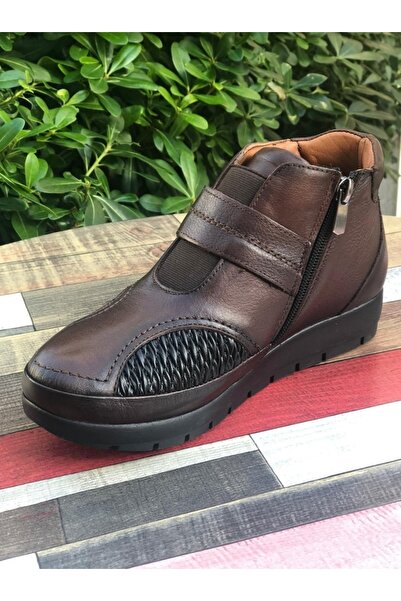 BELOX Kadın Hakiki Deri Ortopedik Kahverengi Kemik Çıkıntısı(halluks Valgus) ...