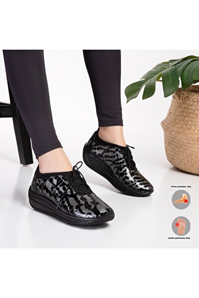 Mira Terlik أحذية ميرا الجلدية النسائية لتقويم العظام مناسبة لبروز العظام