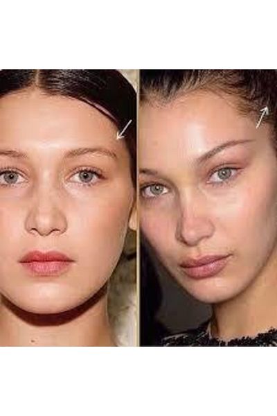 AKOLİFE Cream Beige Color Face Lift Tape - Instant Botox Effect