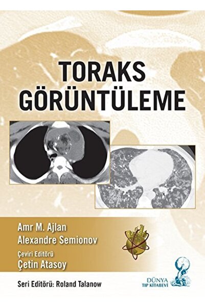 Dünya Tıp Kitabevi Toraks Görüntüleme