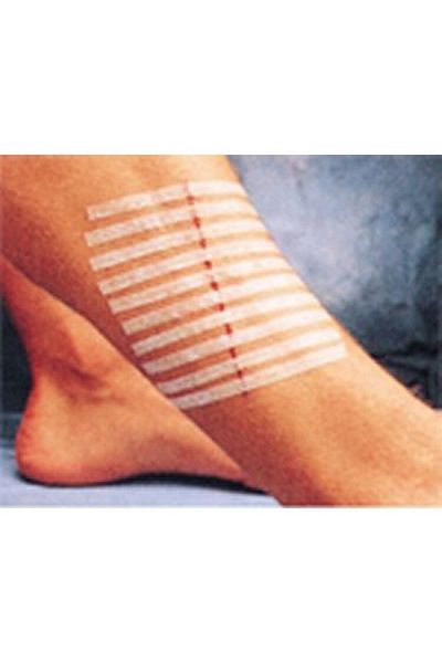 MEDİKAL 3m Steri-strip Sewing Tapes 12mm X 100mm 6 Pieces Strips R1547