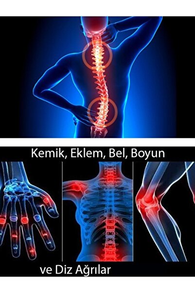 Silver's Naturals Aksöğüt Ekstrakt Ve Alabalık Yağı Kremi-100 Ml