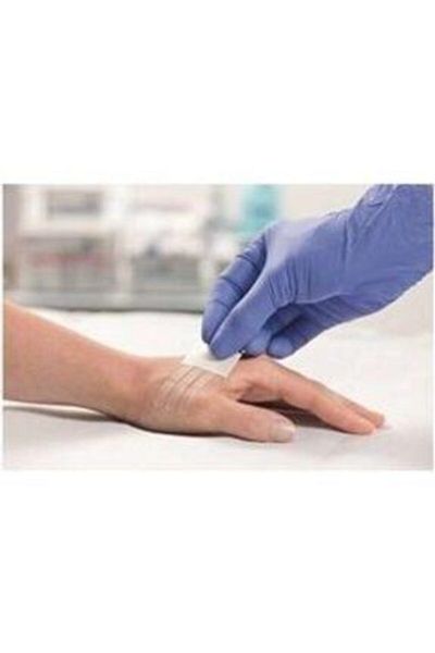 Hartmann شريط خياطة Omnistrip Stripe 6x101mm - 50 قطعة (صندوق واحد)