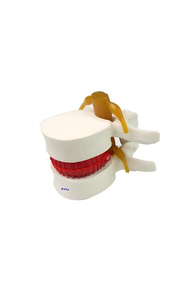 Dr.Flexi Disk Hernisi Fıtık Maketi