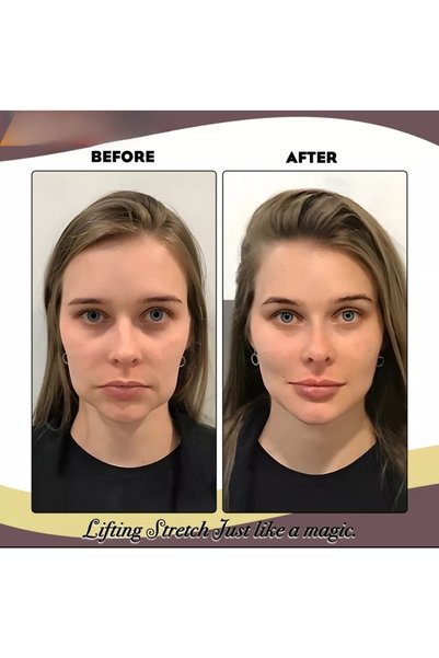 AKOLİFE Botox Effect Hair Clip - Eye, Eyebrow and Face Lift Tape