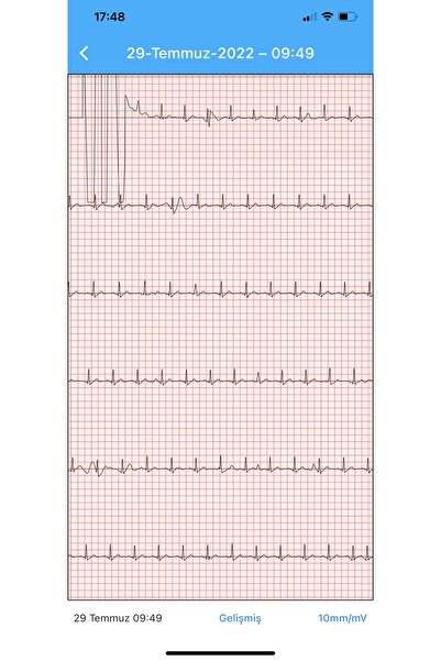 Genel Markalar Android Akıllı Bileklik (EKG, NABIZ, SOLUNUM HIZI, VÜCUT İSISI, AKTİVİTE VE UYKU VERİSİ) 2 Yıl Yok