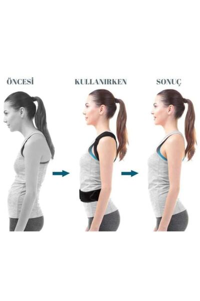 Ankaflex Orthopedic Upright Posture Corset Underwire Magnetic Anti-Hunchback Corset Men's Back Corset