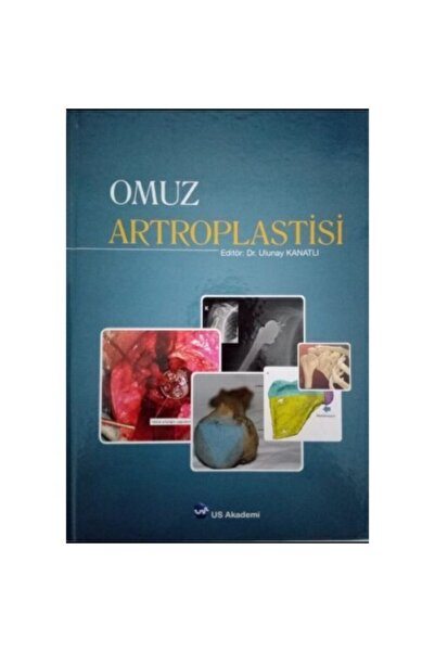 US Akademi Omuz Artroplastisi