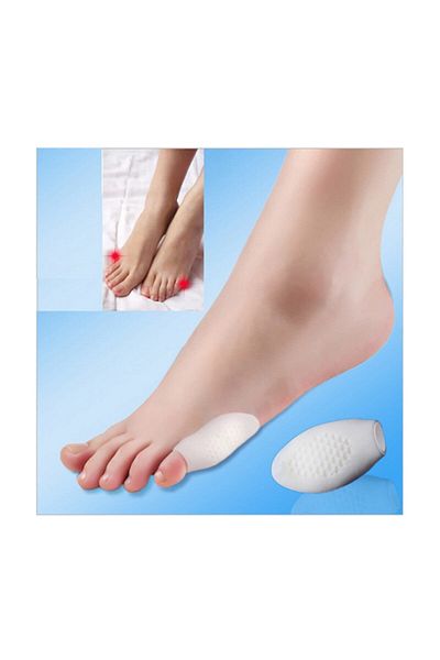 CMT Foot Little Finger Bunion Without Roller (Set of 2)