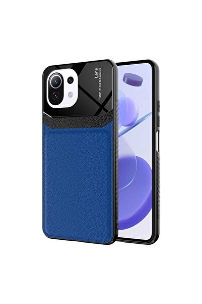 ZM STORE Xiaomi Mi 11 Lite Kılıf Parlak Yüzey Deri Görünümlü Kapak
