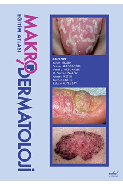 Nobel Tıp Kitabevi Makrodermatoloji Eğitim Atlası