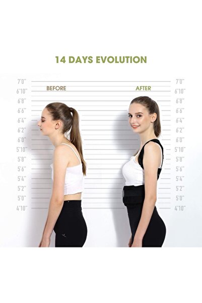 ZEYZEN Upright Posture Corset Orthopedic Anti-Hunchback Waist Back Shoulder Corset Apparatus For Women Men Standing