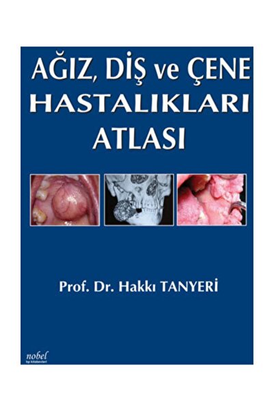 Nobel Tıp Kitabevi Ağız, Diş ve Çene Hastalıkları Atlası - Kolektif