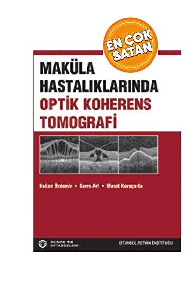 Güneş Tıp Kitabevleri Maküla Hastalıklarında Optik Koherens Tomografi