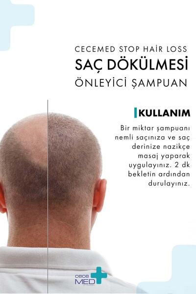 cece med Saç Dökülme Karşıtı Şampuan Stop Hair Loss Shampoo 300 Ml 2 Adet 59075065340062