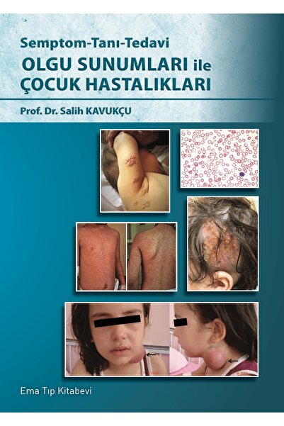 Ema Tıp Kitabevi Olgu Sunumları ile Çocuk Hastalıkları - Semptom - Tanı - Tedavi